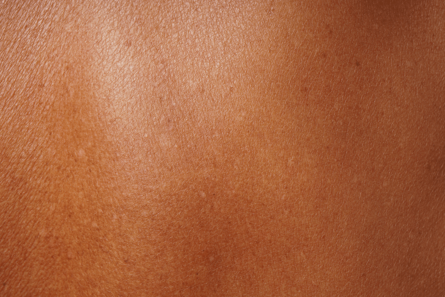 eucalyptus skin benefits