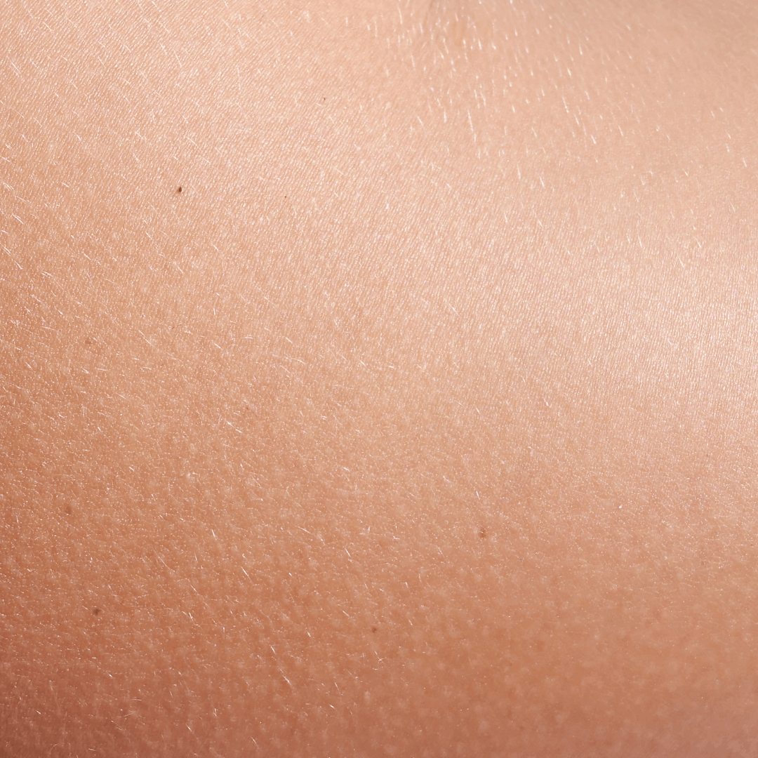 Supports Skin Health